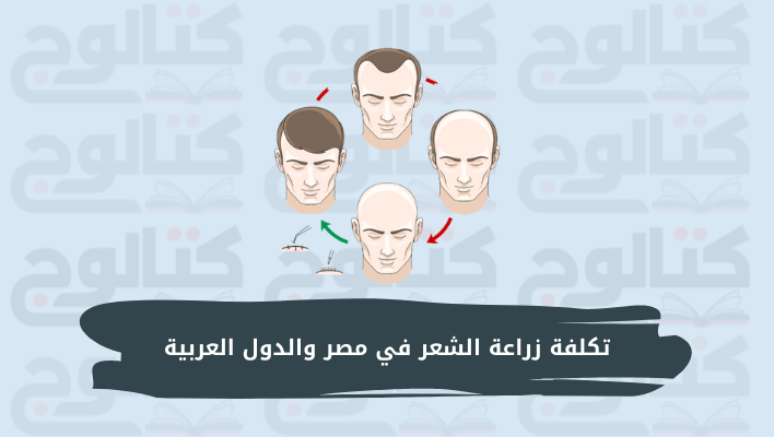تكلفة زراعة الشعر في مصر والدول العربية